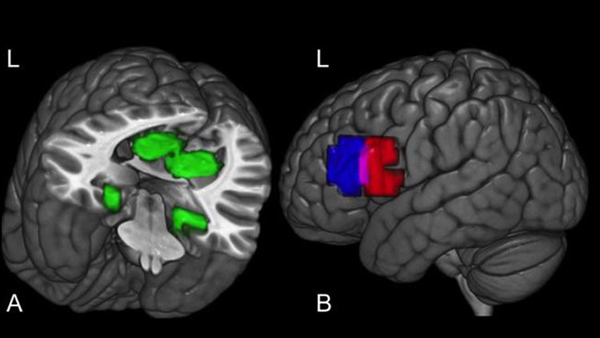 Revelan secreto de cómo se forman nuevos conceptos en el cerebro