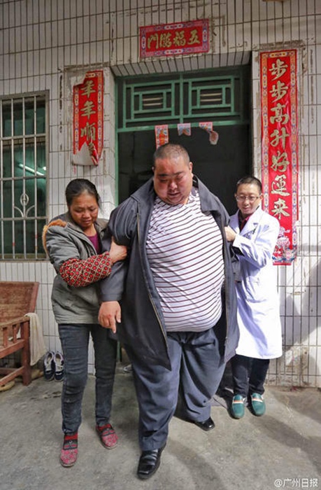 El hombre más gordo de China pesa 261 kilos