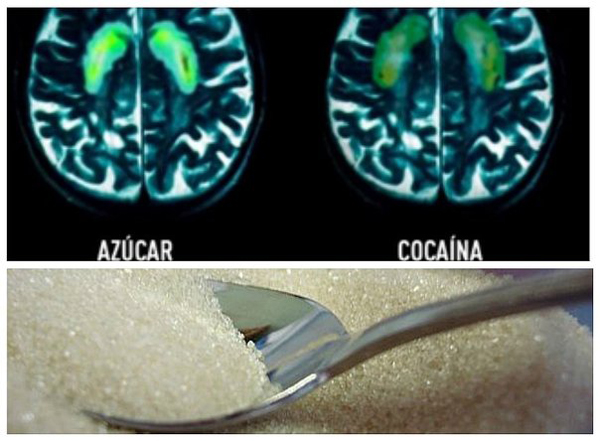 El azúcar puede provocar los mismos 
efectos que la cocaína