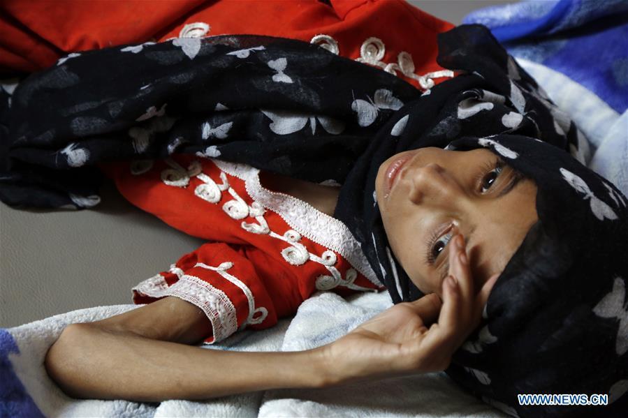 El hambre y la desnutrición: asesinos silencios de ni?os en Yemen